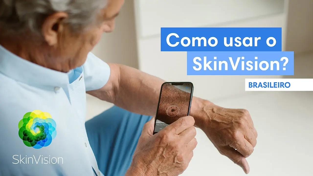 Veja como o SkinVision funciona