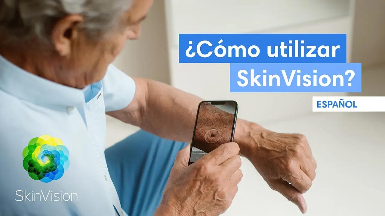 Descubrí cómo funciona SkinVision