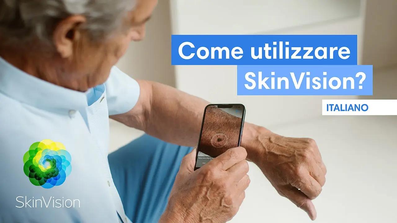 Scopri come funziona SkinVision