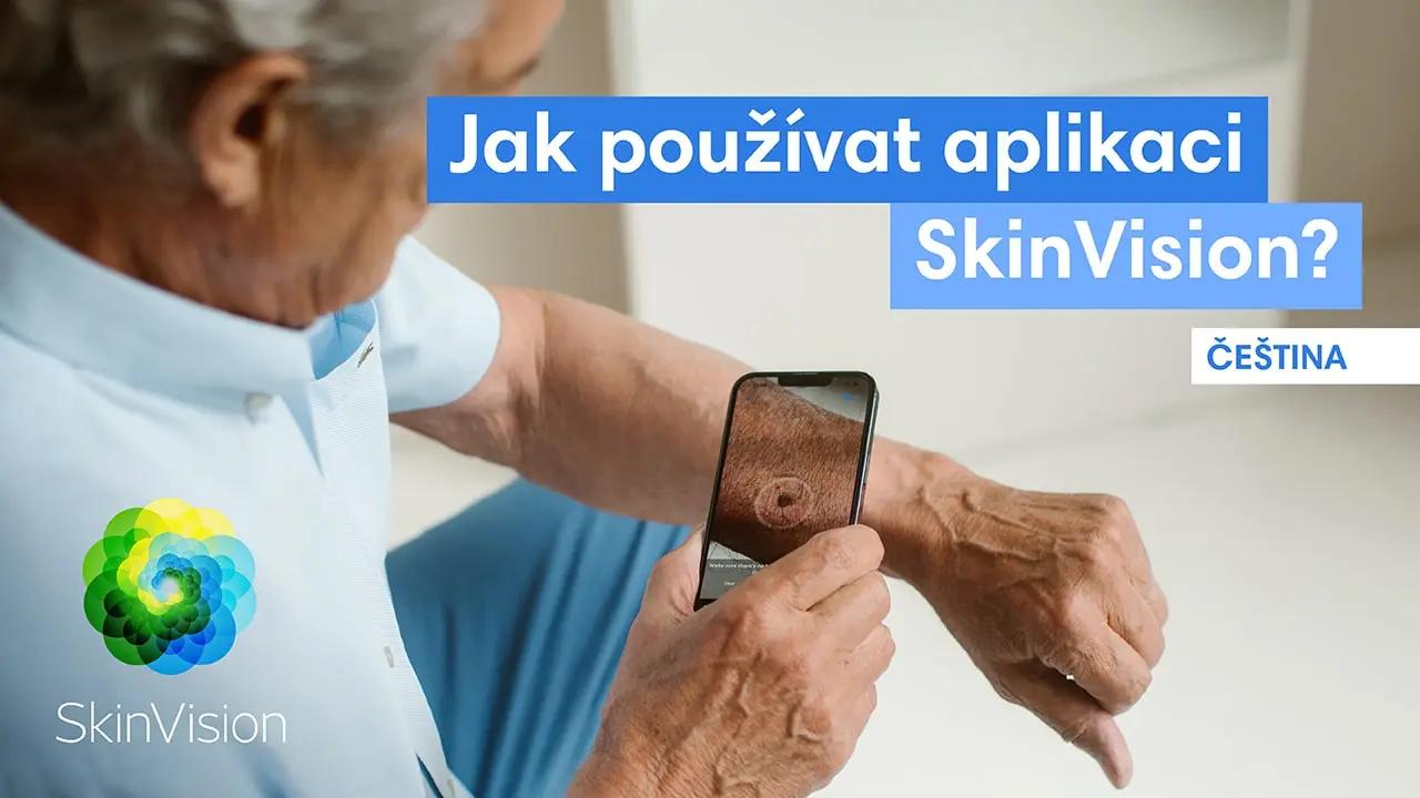 Podívejte se, jak funguje SkinVision