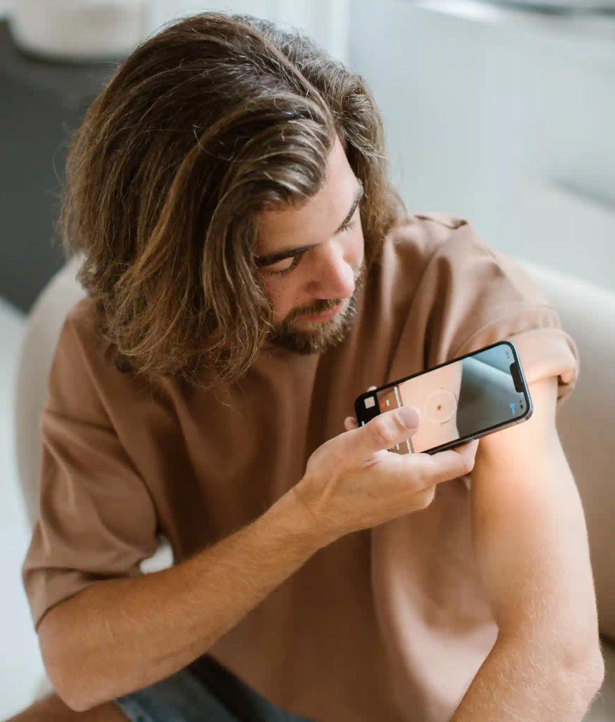 Why SkinVision